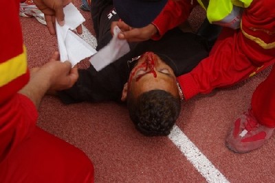 فريق طبي بسلا يضع 30 غرزة لإنقاذ مشجع الكوكب المراكشي الذي تعرض لطعنة بالعنق من قبل مشجع آخر فريق طبي بسلا يضع 30 غرزة لإنقاذ مشجع الكوكب المراكشي الذي تعرض لطعنة بالعنق من قبل مشجع آخر